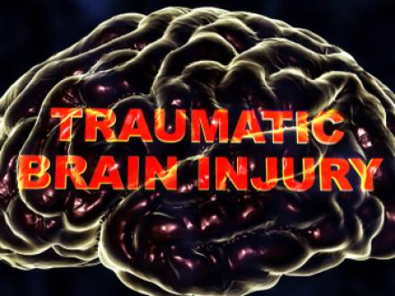 Chicago, IL Brain Injury Lawyer